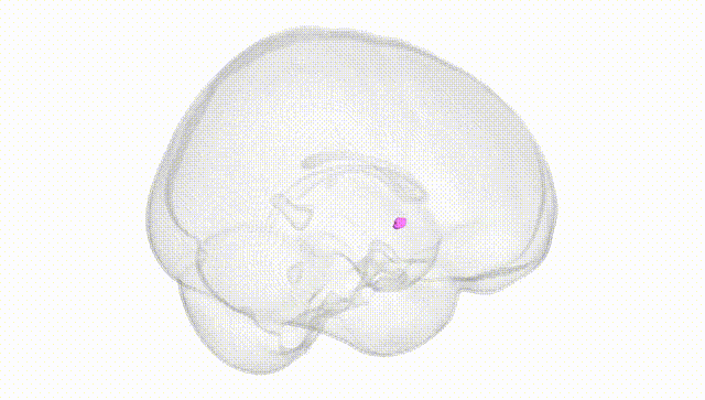 Full Brain White