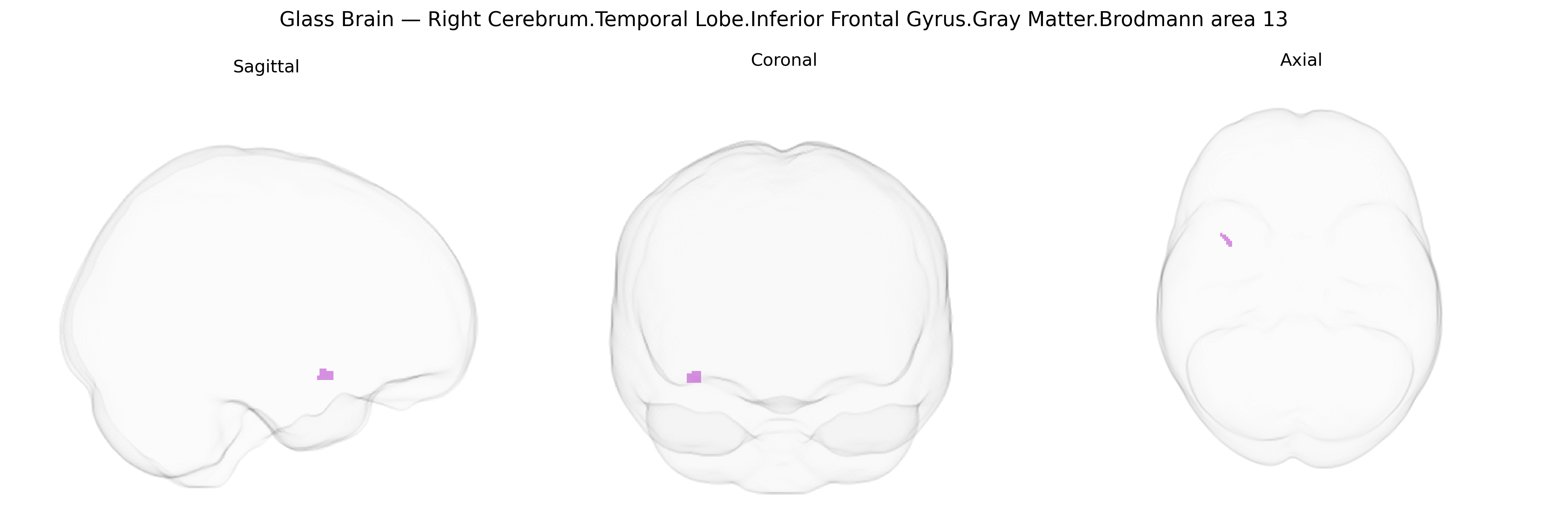 Triplanar Ghost Brain