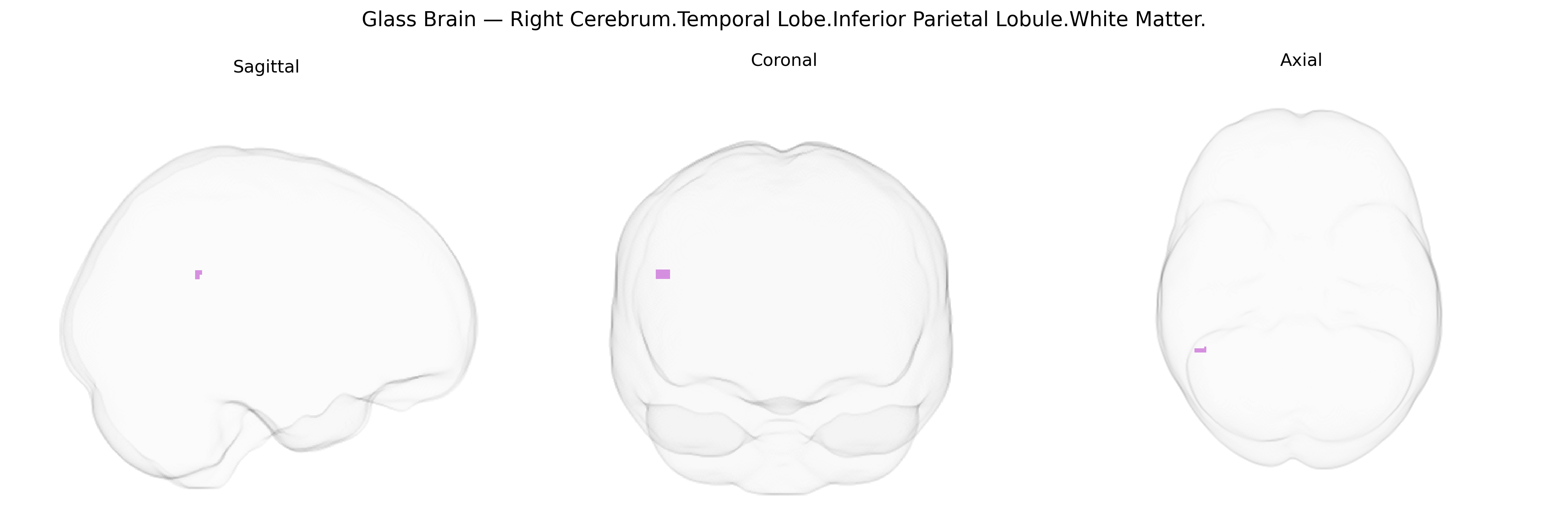 Triplanar Ghost Brain
