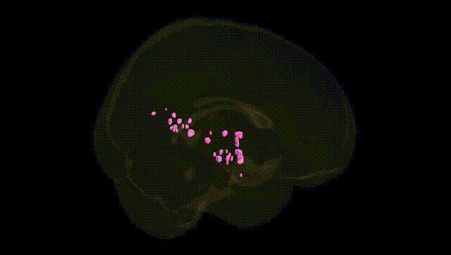 Full Brain Black