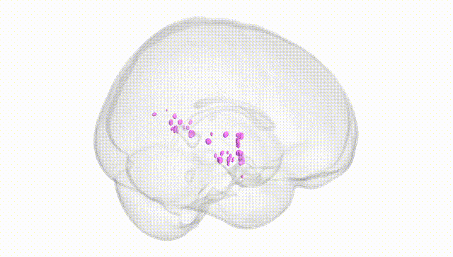 Full Brain White