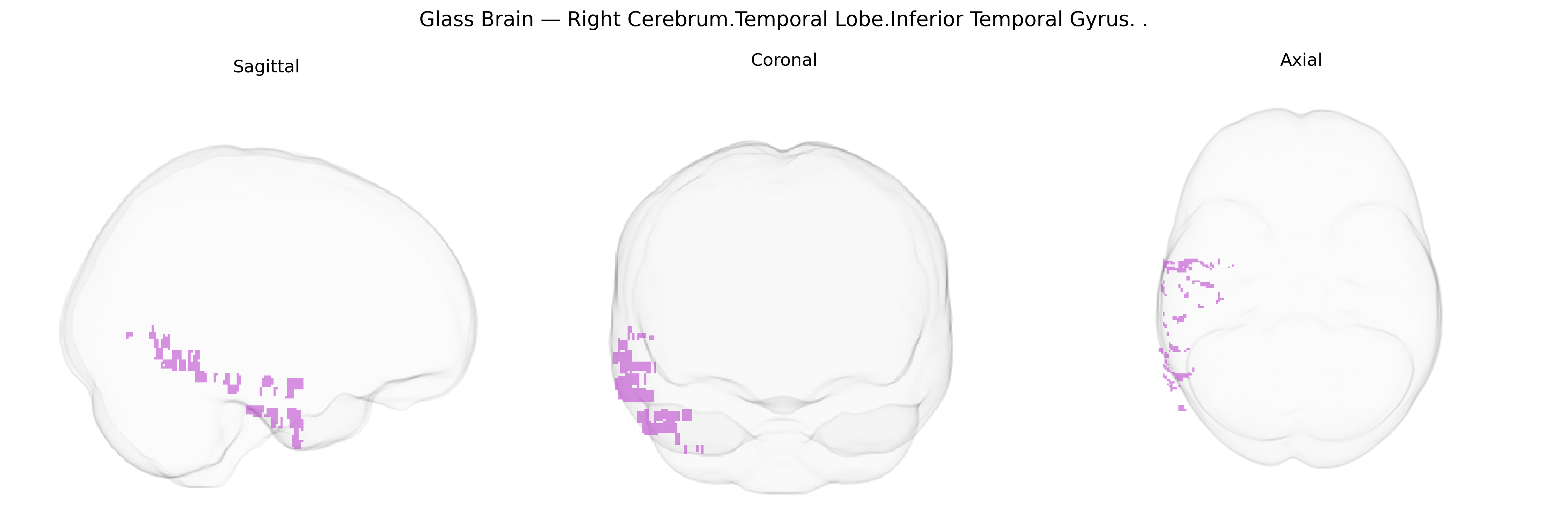 Triplanar Ghost Brain