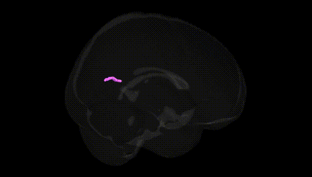 Full Brain Black