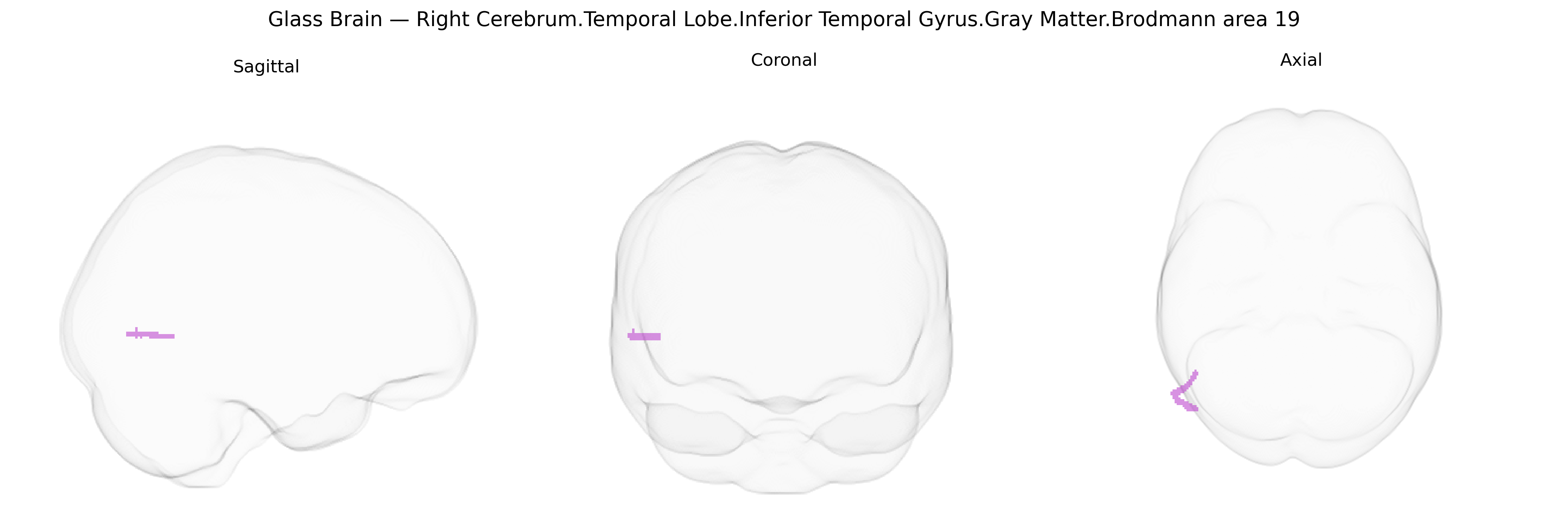 Triplanar Ghost Brain