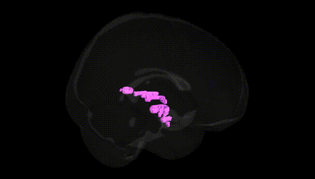 Full Brain Black