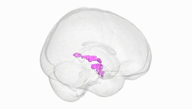 Full Brain White