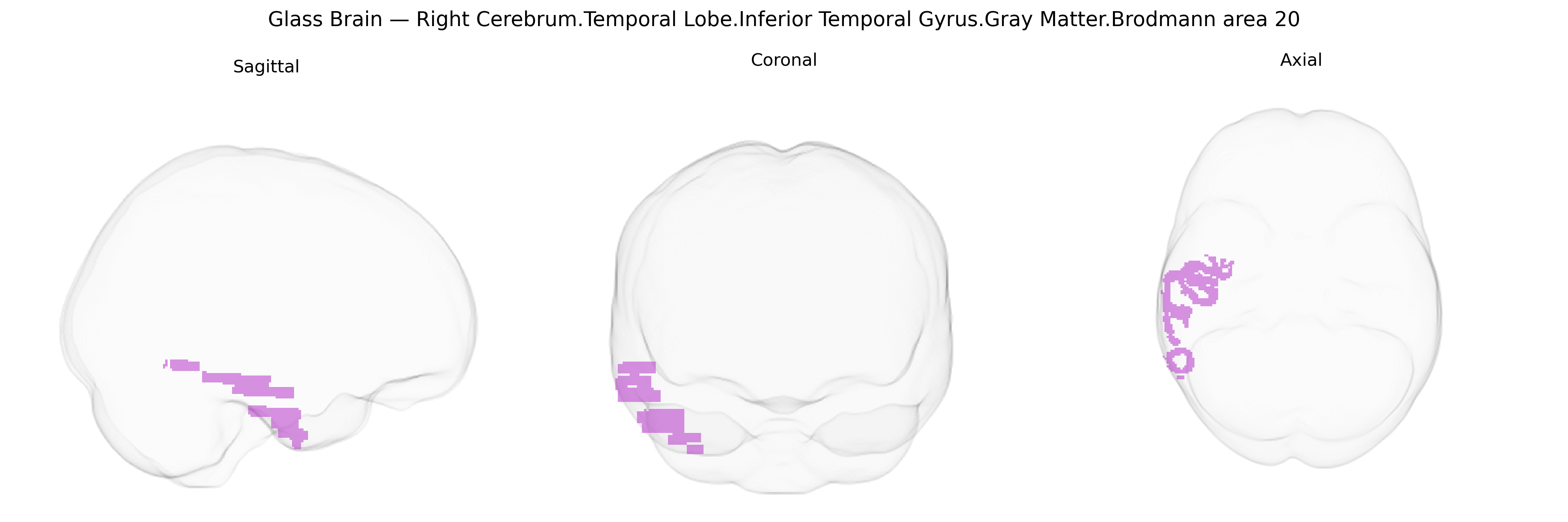 Triplanar Ghost Brain
