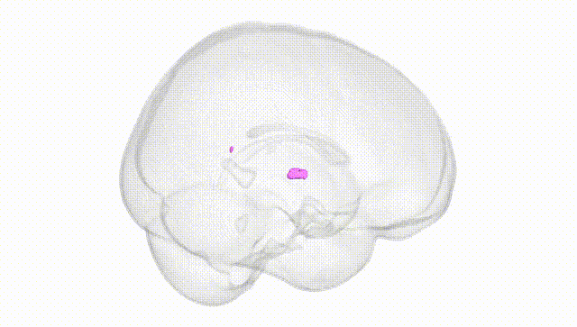 Full Brain White
