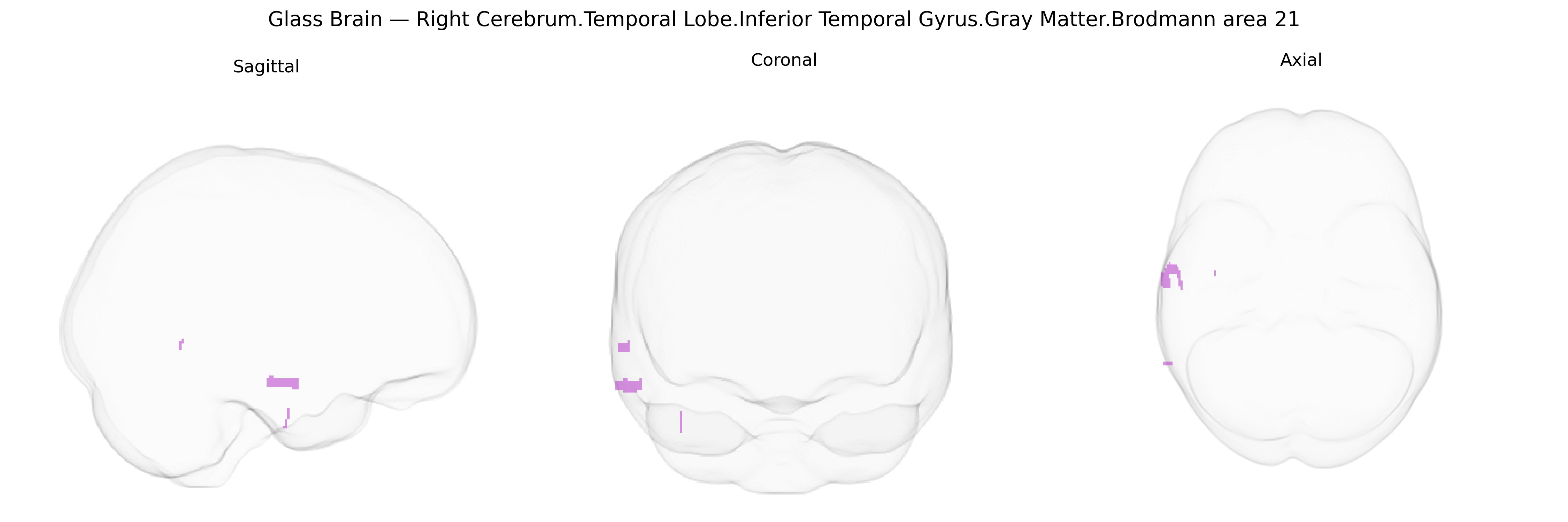 Triplanar Ghost Brain