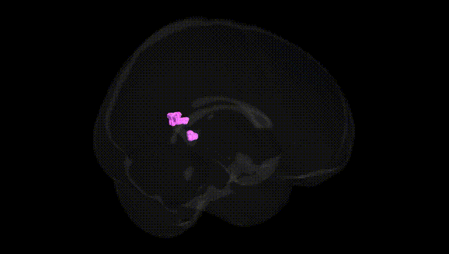 Full Brain Black