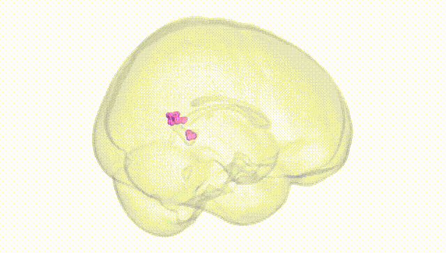 Full Brain White