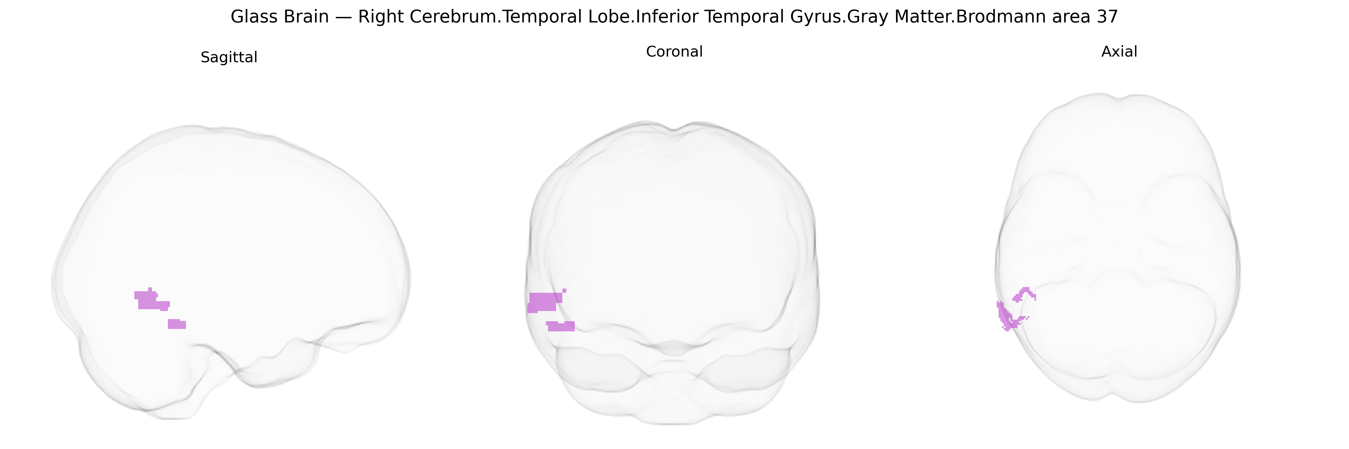 Triplanar Ghost Brain