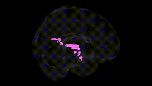 Full Brain Black