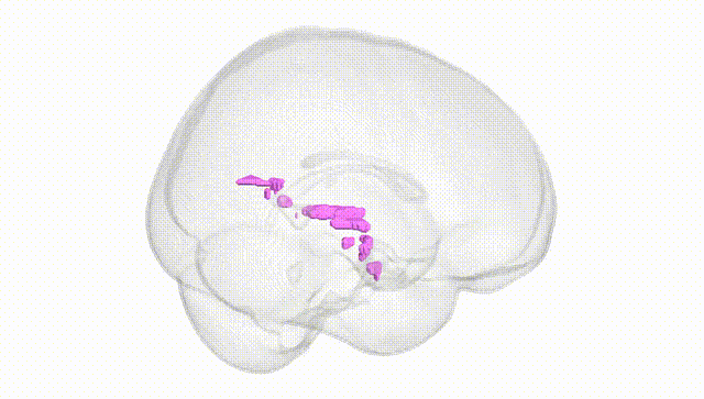 Full Brain White