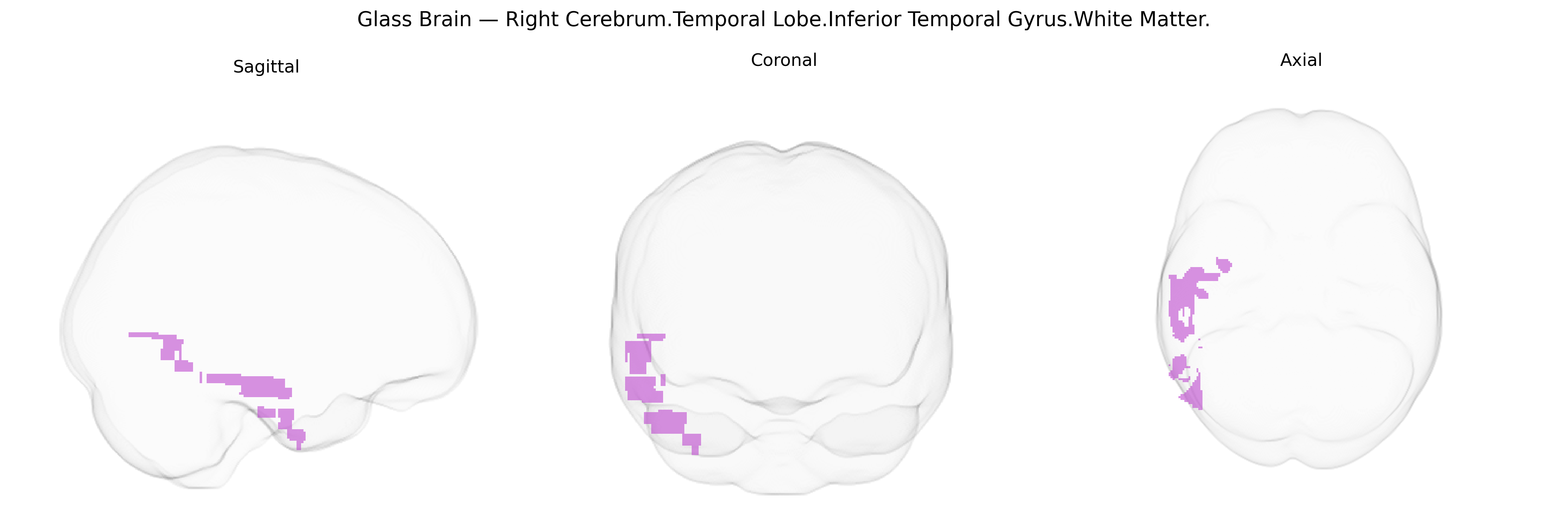 Triplanar Ghost Brain