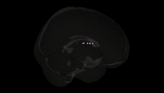 Full Brain Black