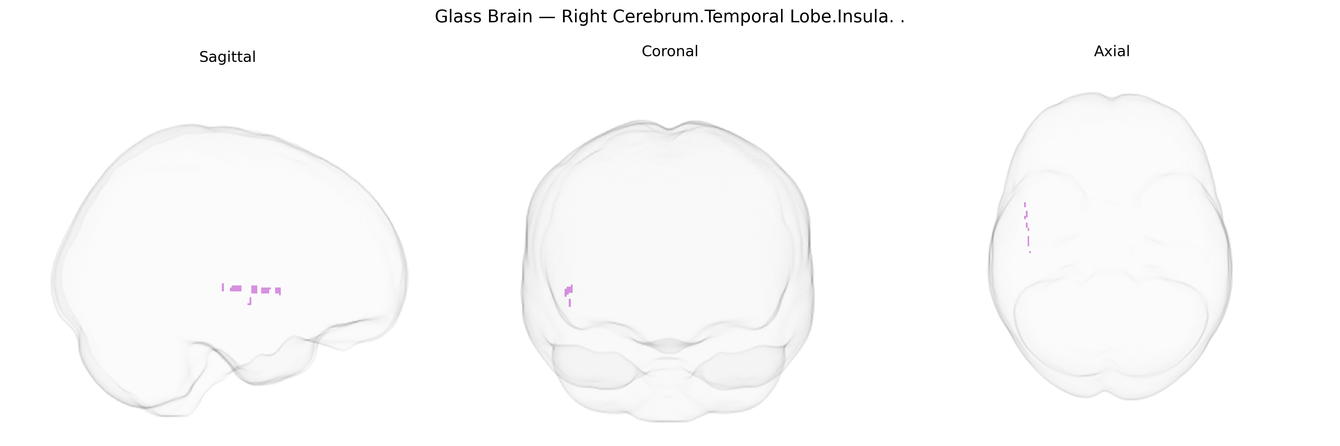 Triplanar Ghost Brain