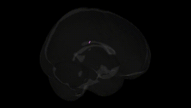 Full Brain Black
