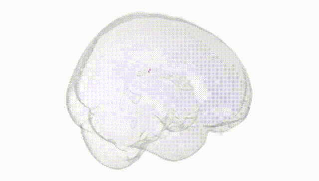 Full Brain White