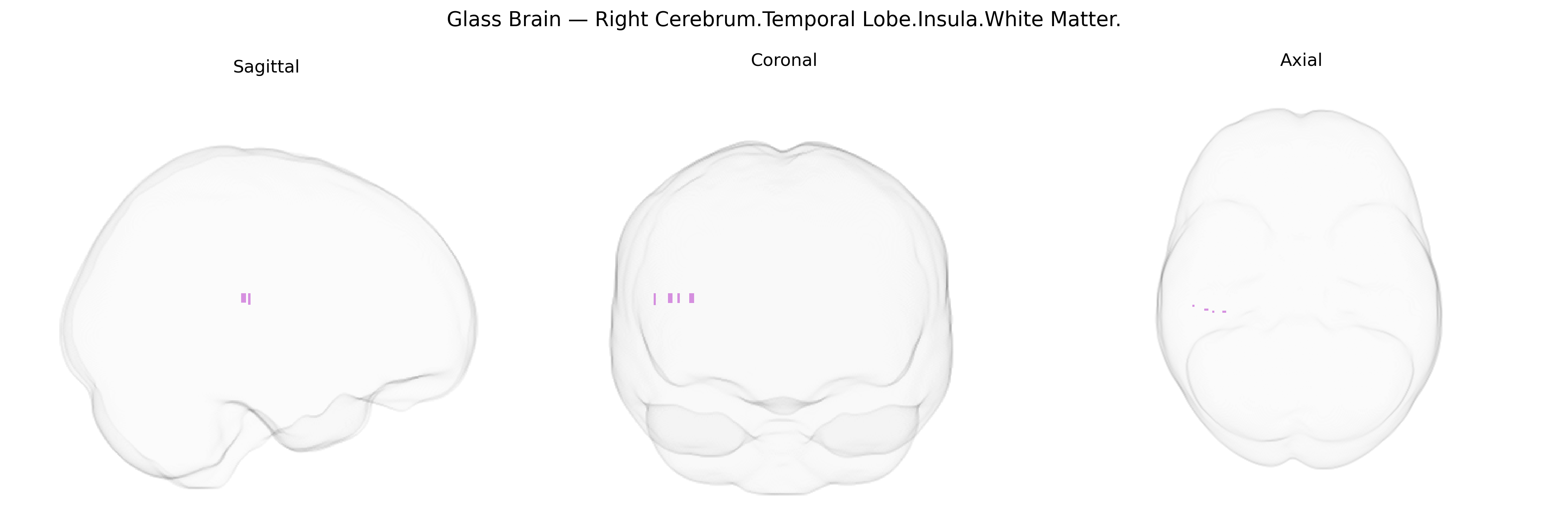 Triplanar Ghost Brain