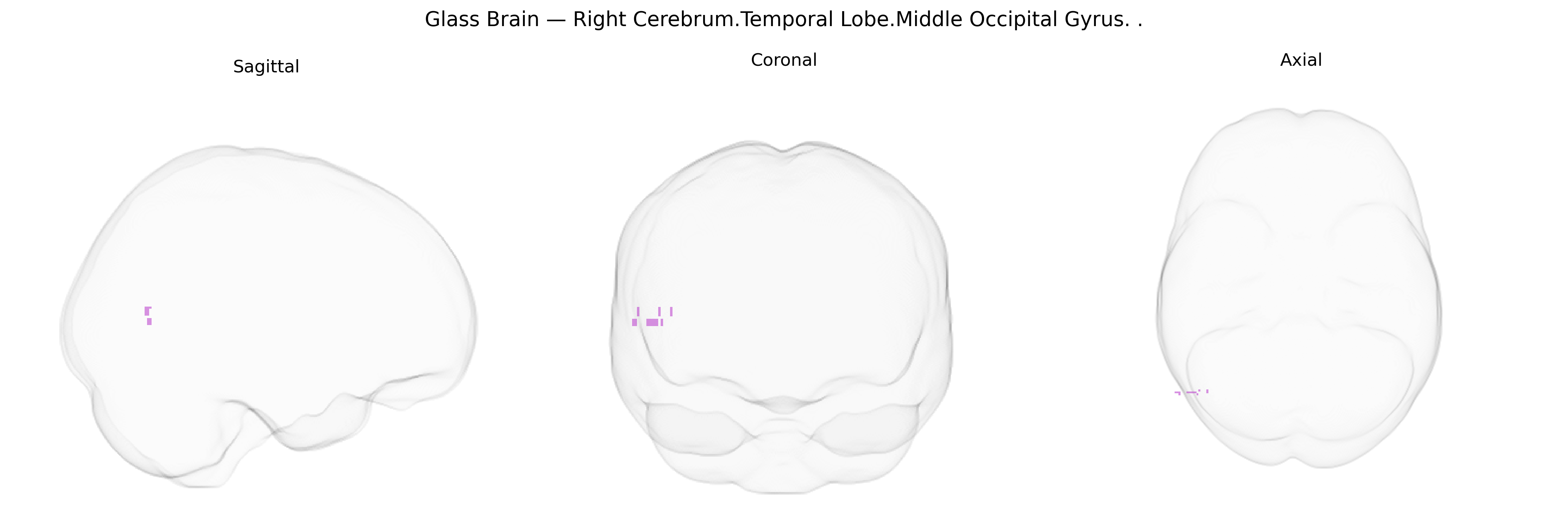 Triplanar Ghost Brain