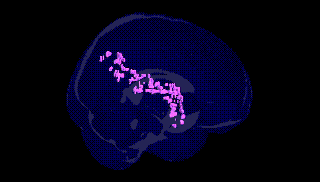 Full Brain Black