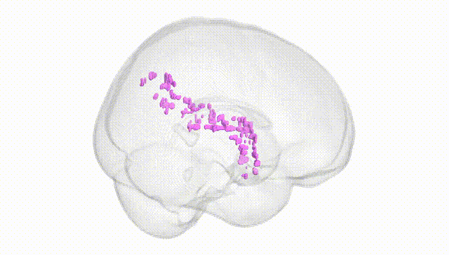 Full Brain White