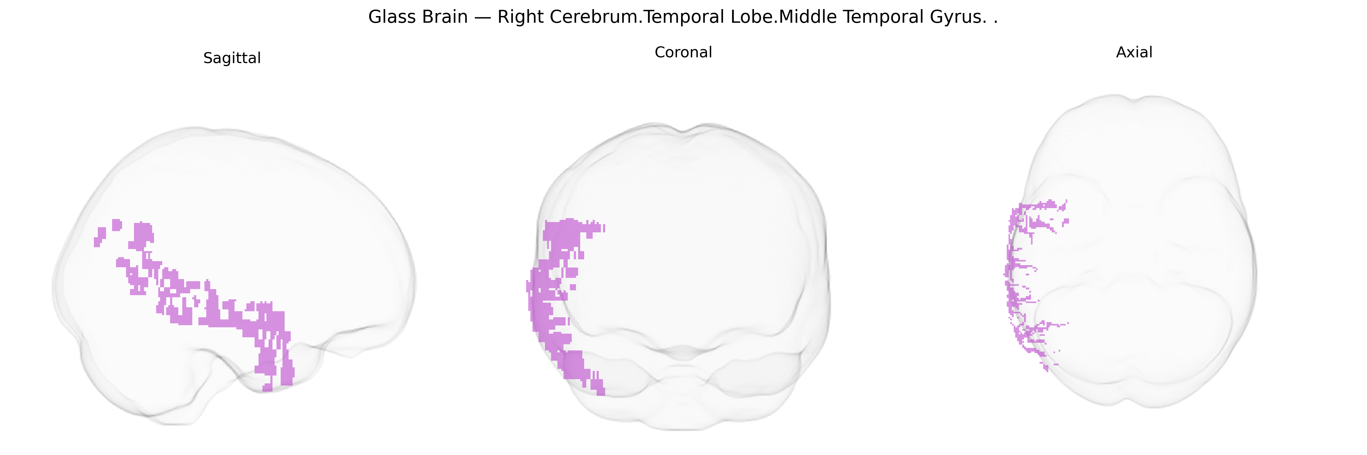Triplanar Ghost Brain