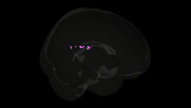Full Brain Black