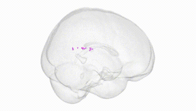 Full Brain White