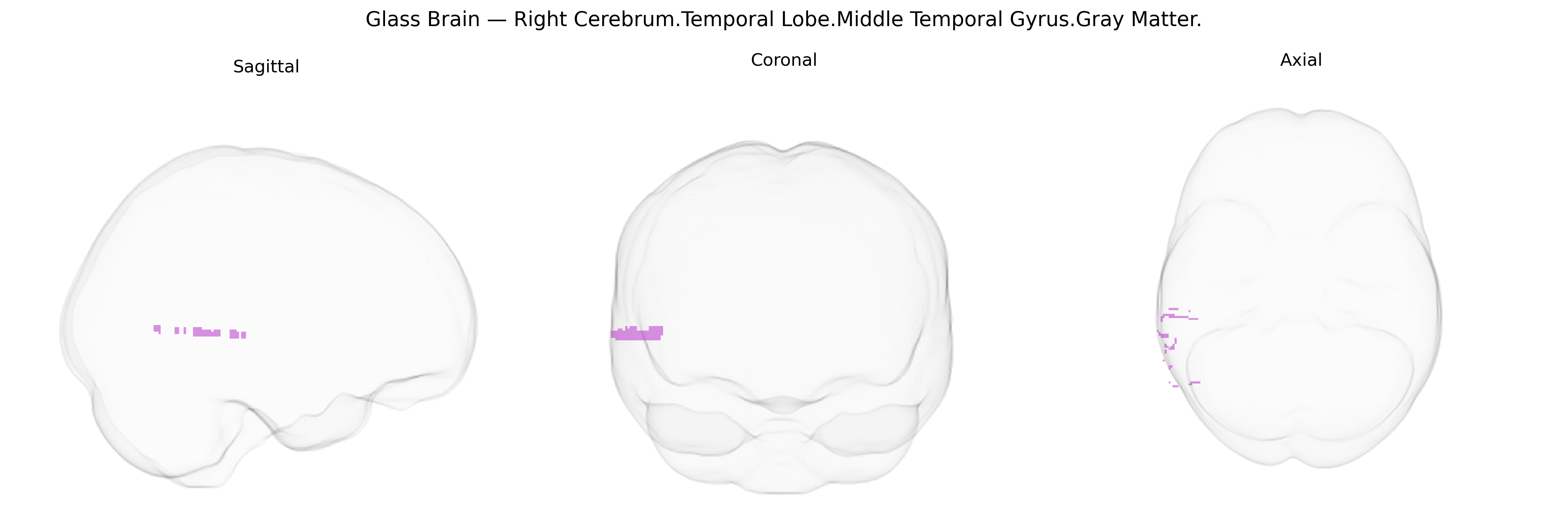 Triplanar Ghost Brain