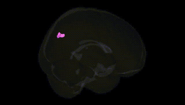 Full Brain Black