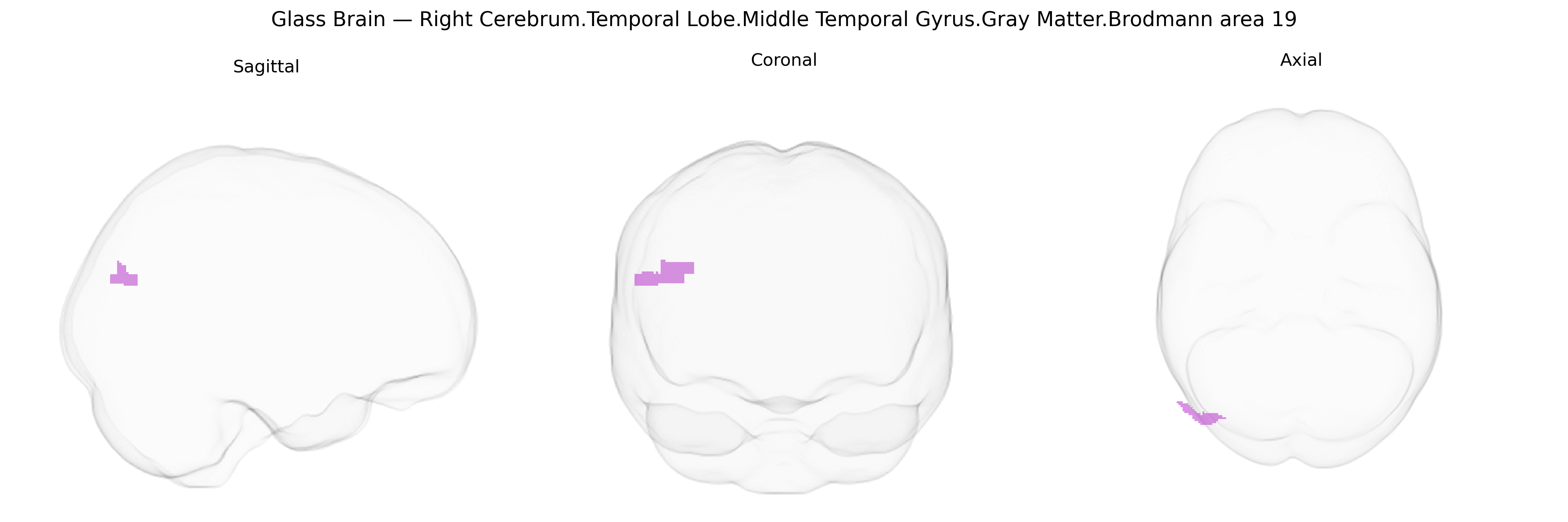 Triplanar Ghost Brain