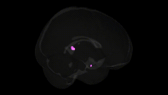 Full Brain Black