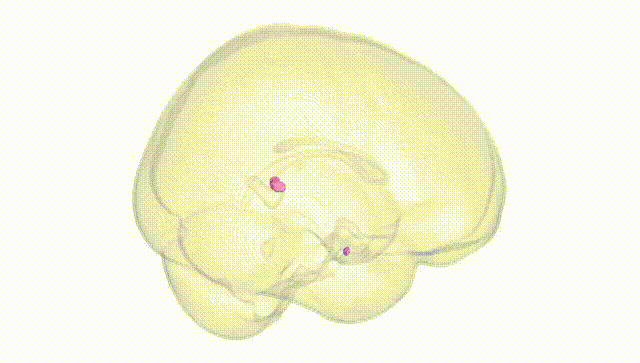 Full Brain White