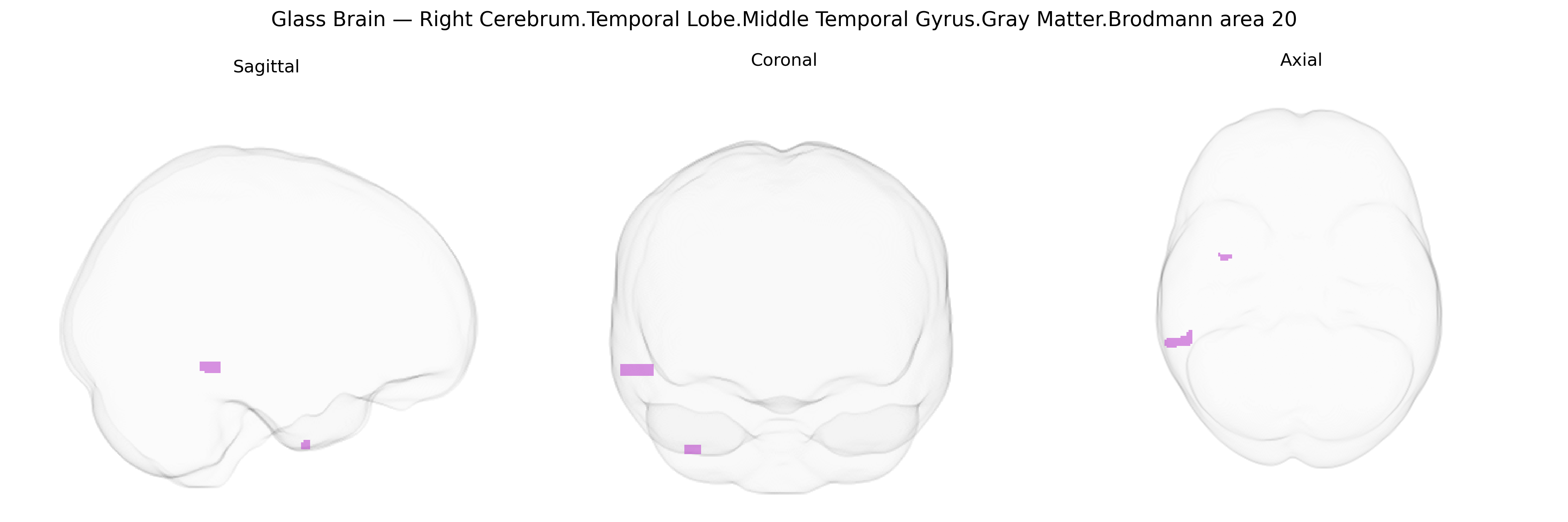 Triplanar Ghost Brain