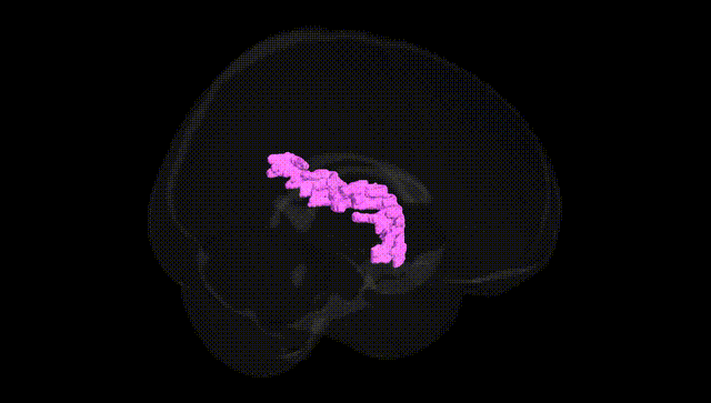 Full Brain Black