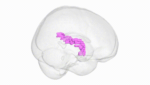 Full Brain White