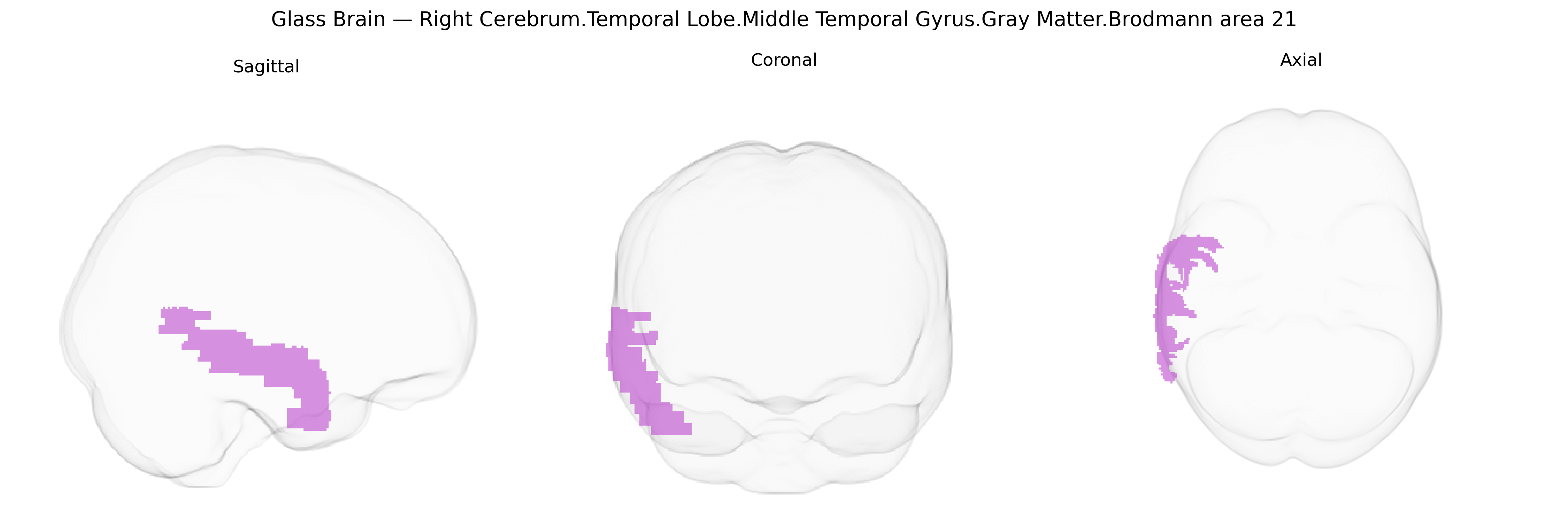 Triplanar Ghost Brain