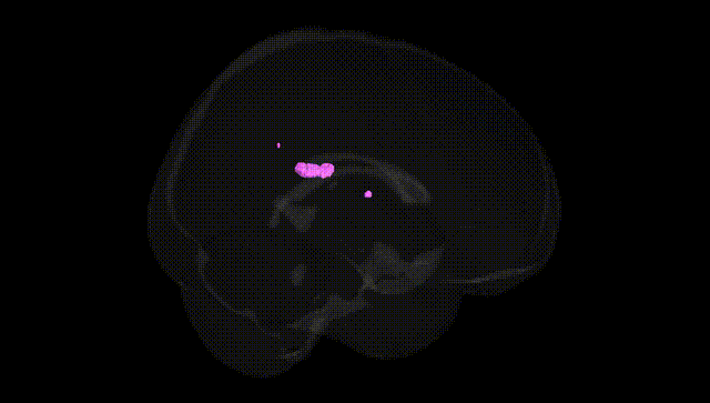 Full Brain Black
