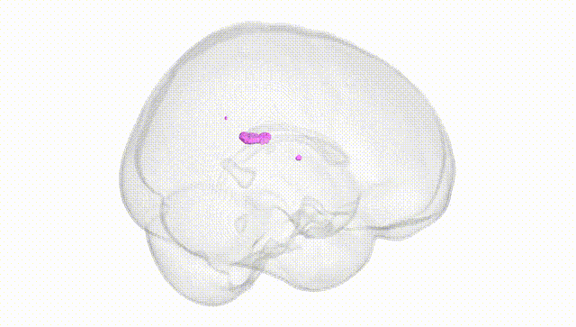 Full Brain White