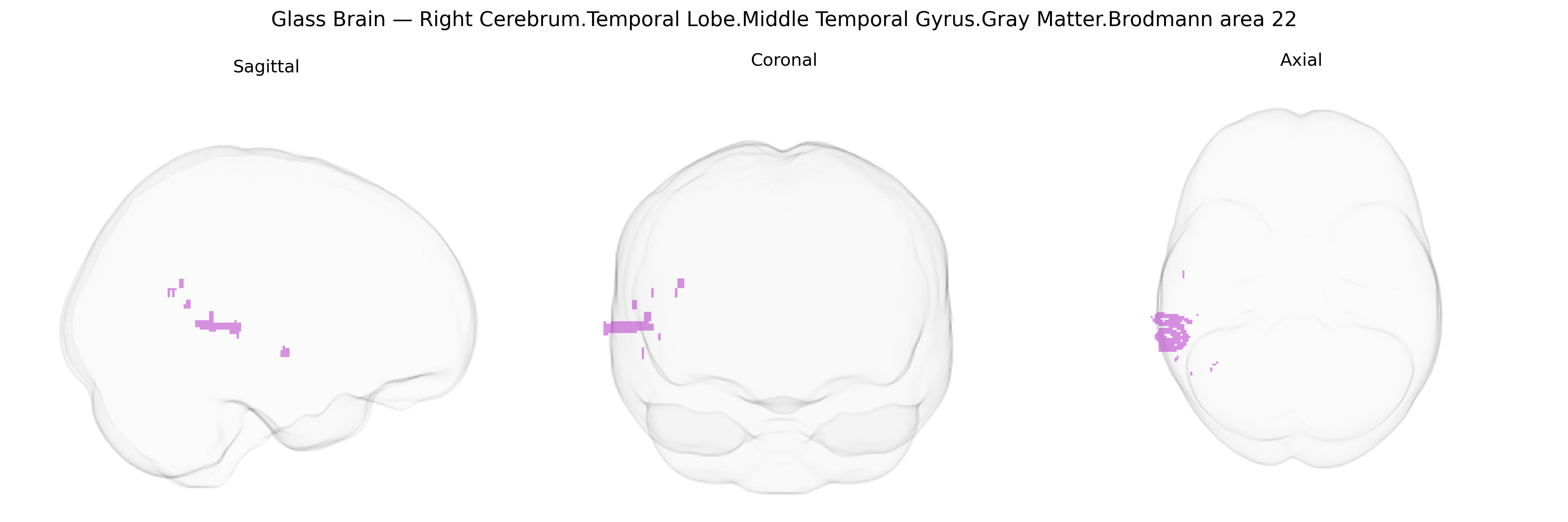 Triplanar Ghost Brain