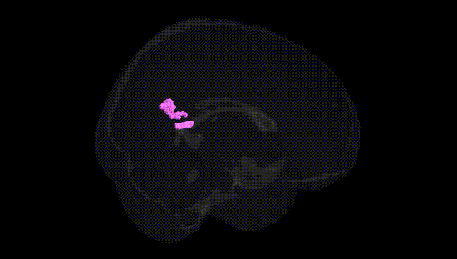 Full Brain Black