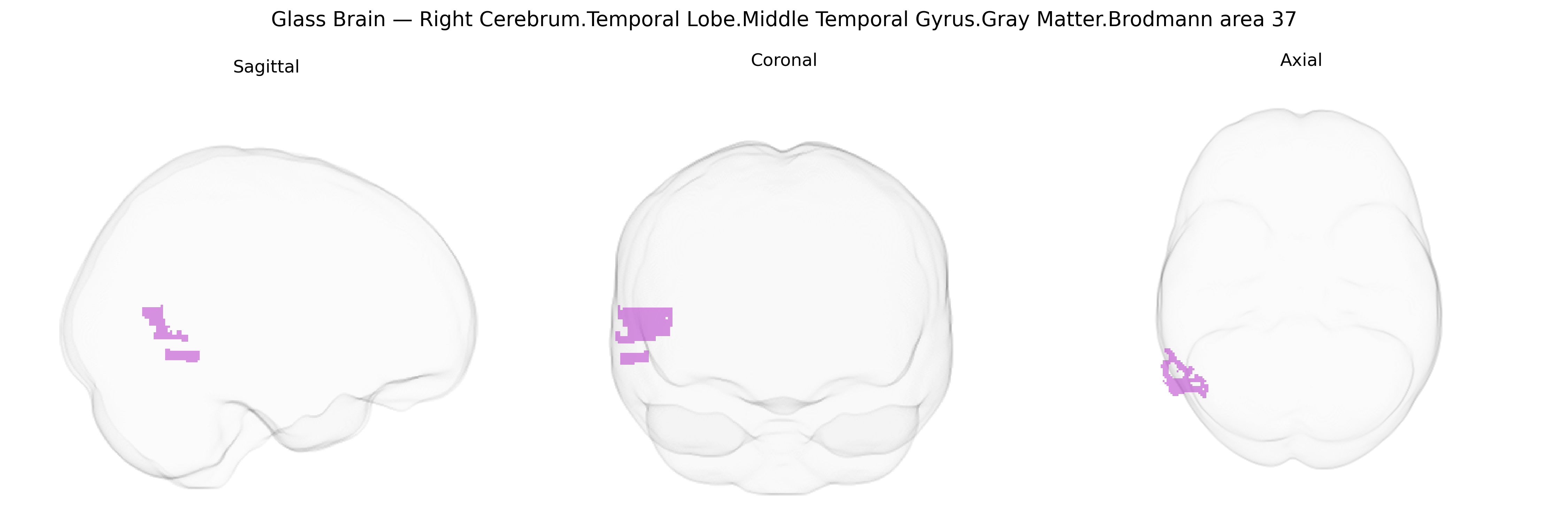 Triplanar Ghost Brain