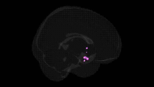 Full Brain Black