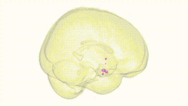 Full Brain White