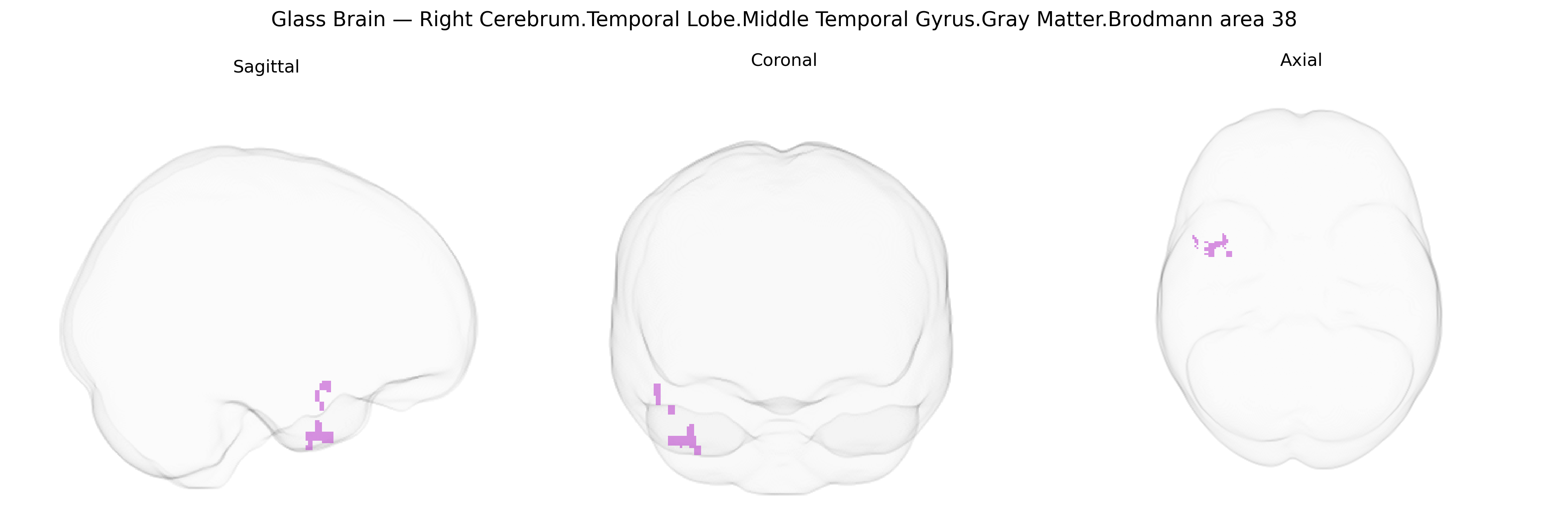 Triplanar Ghost Brain