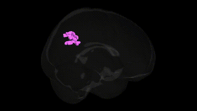 Full Brain Black