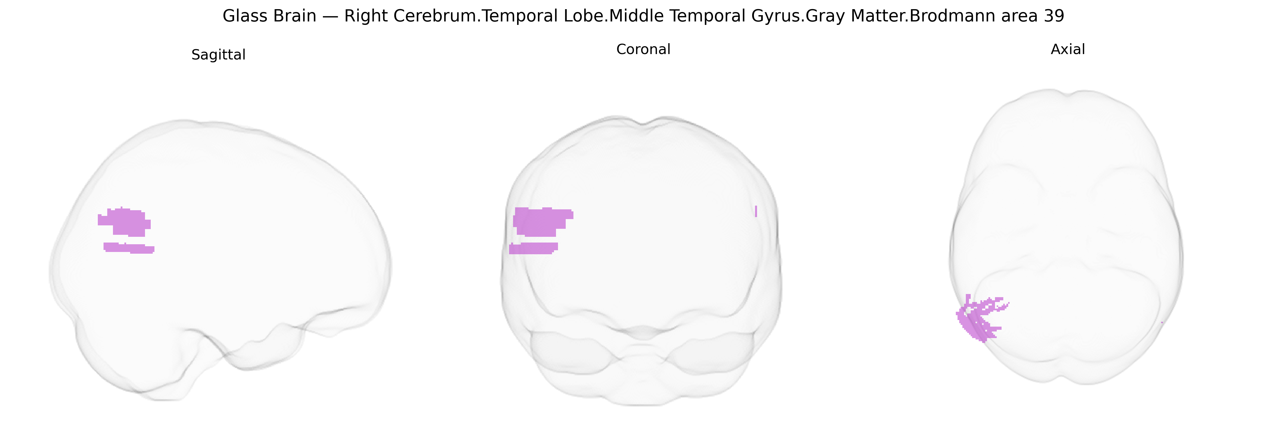 Triplanar Ghost Brain