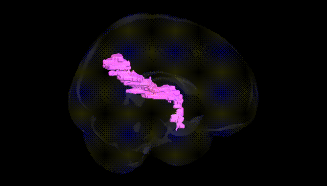 Full Brain Black